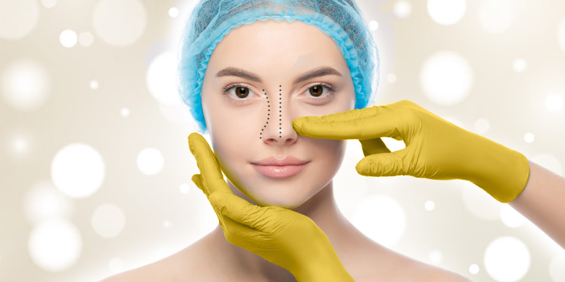 What to Expect After Rhinoplasty Surgery?