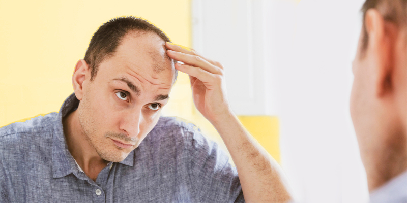 IS YOUR HAIR FALLING OUT? HAVE YOU CONSULTED AN EXPERT YET? GET ANSWERS TO YOUR HAIR LOSS WOES.