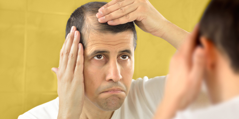 WHAT CAUSES HAIR FALL? WHAT ARE THE DIFFERENT TREATMENTS TO CURE HAIR LOSS?