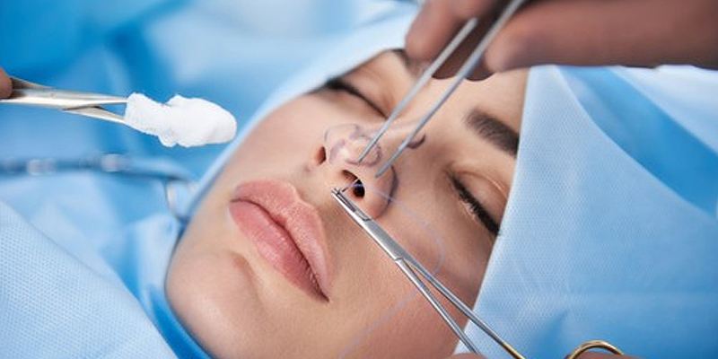 Everything To know About Rhinoplasty Surgery