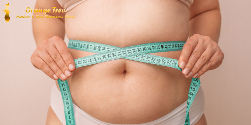 Say Goodbye to Stubborn Belly Fat with Effective Removal Procedures at Orange Tree Aesthetics
