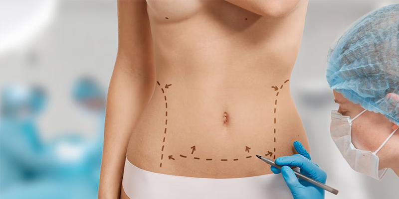 What You Should Not Do Before a Liposuction Surgery?
