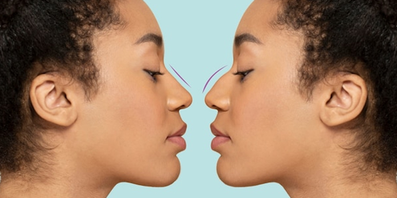 What is the difference between rhinoplasty and septoplasty?